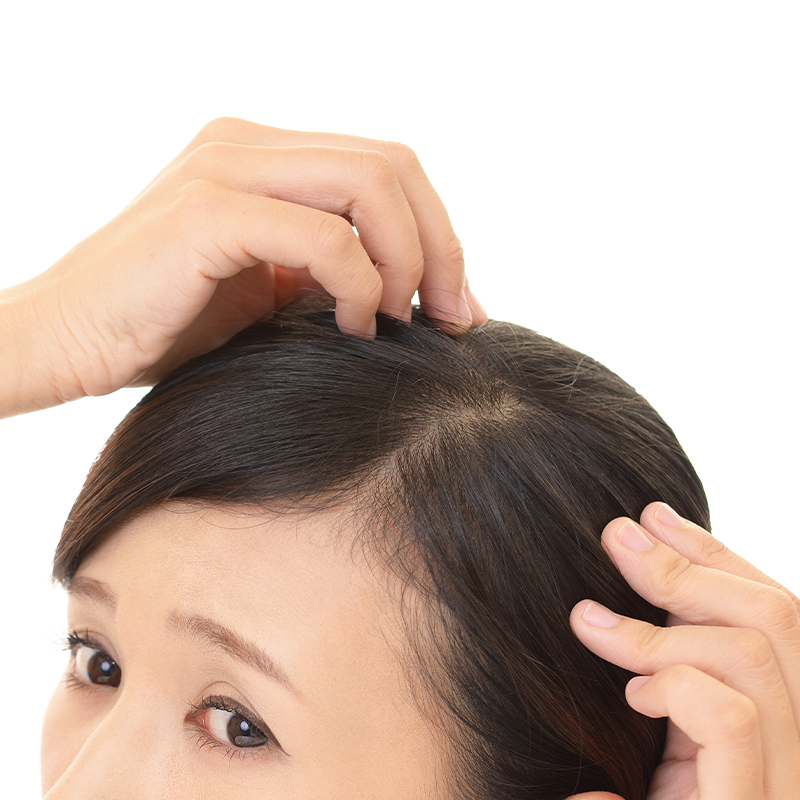 ヘアーフィラー（毛髪再生治療）の効果イメージ画像